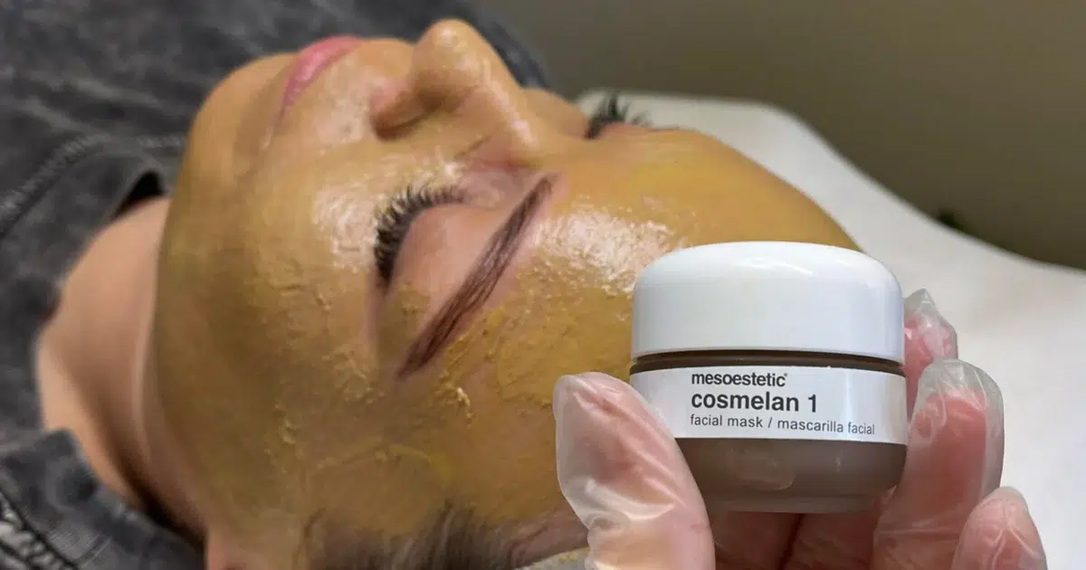 Жена държи продукт Cosmelan 1 на mesoestetic по време на процедура