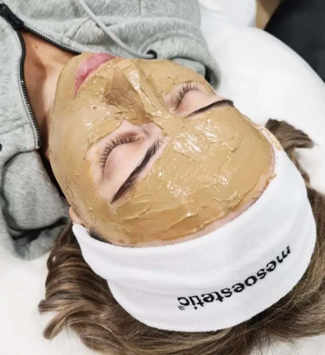 Жена с нанесена маска за лице от mesoestetic