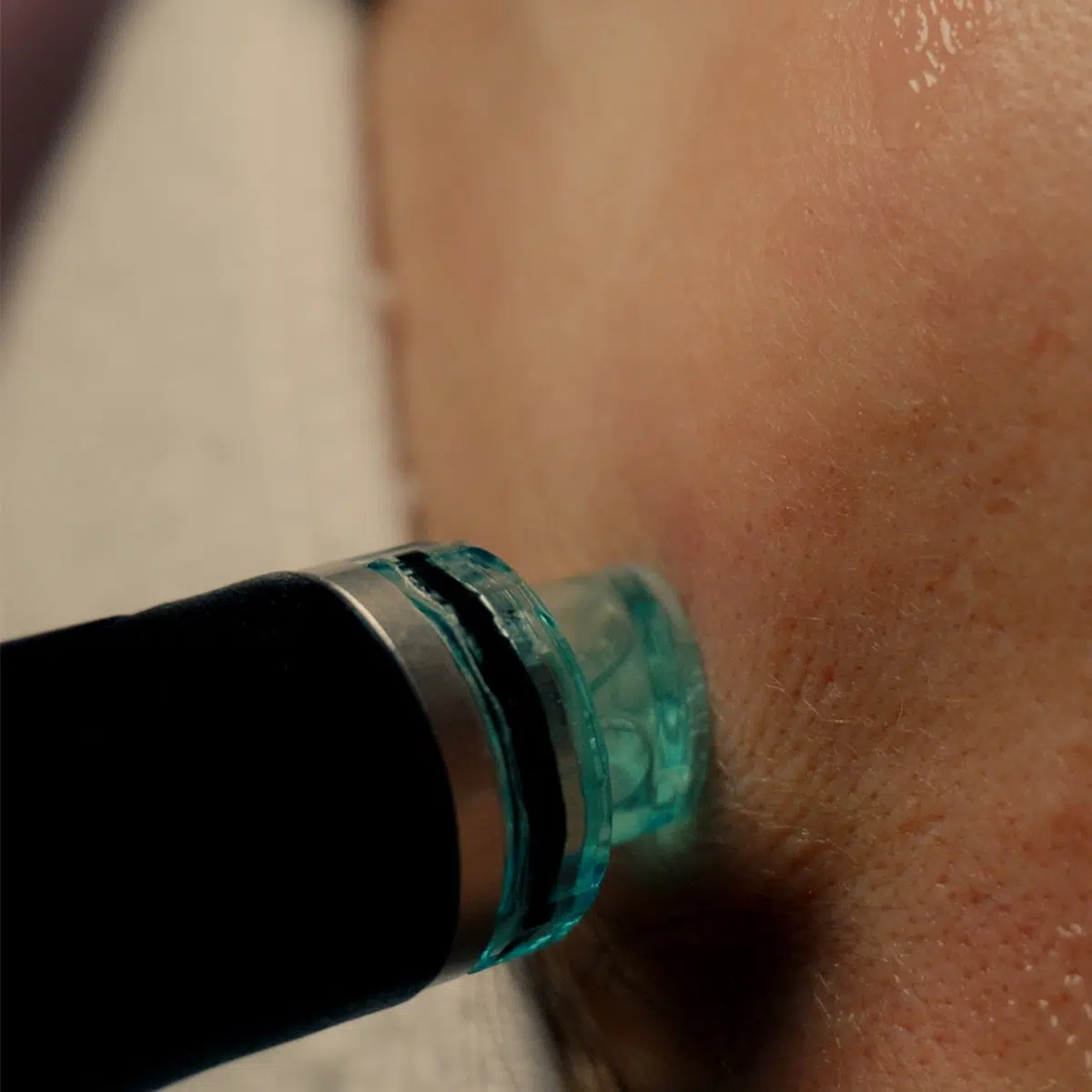 Почистване на кожата с Hydrafacial.