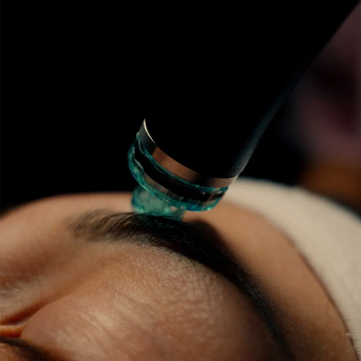 Отблизо накрайник на апарат за Hydrafacial на кожата