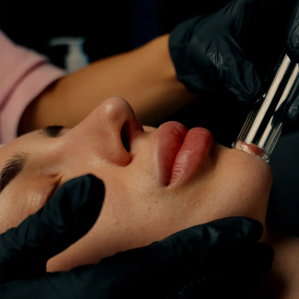 Лимфен дренаж на Hydrafacial.