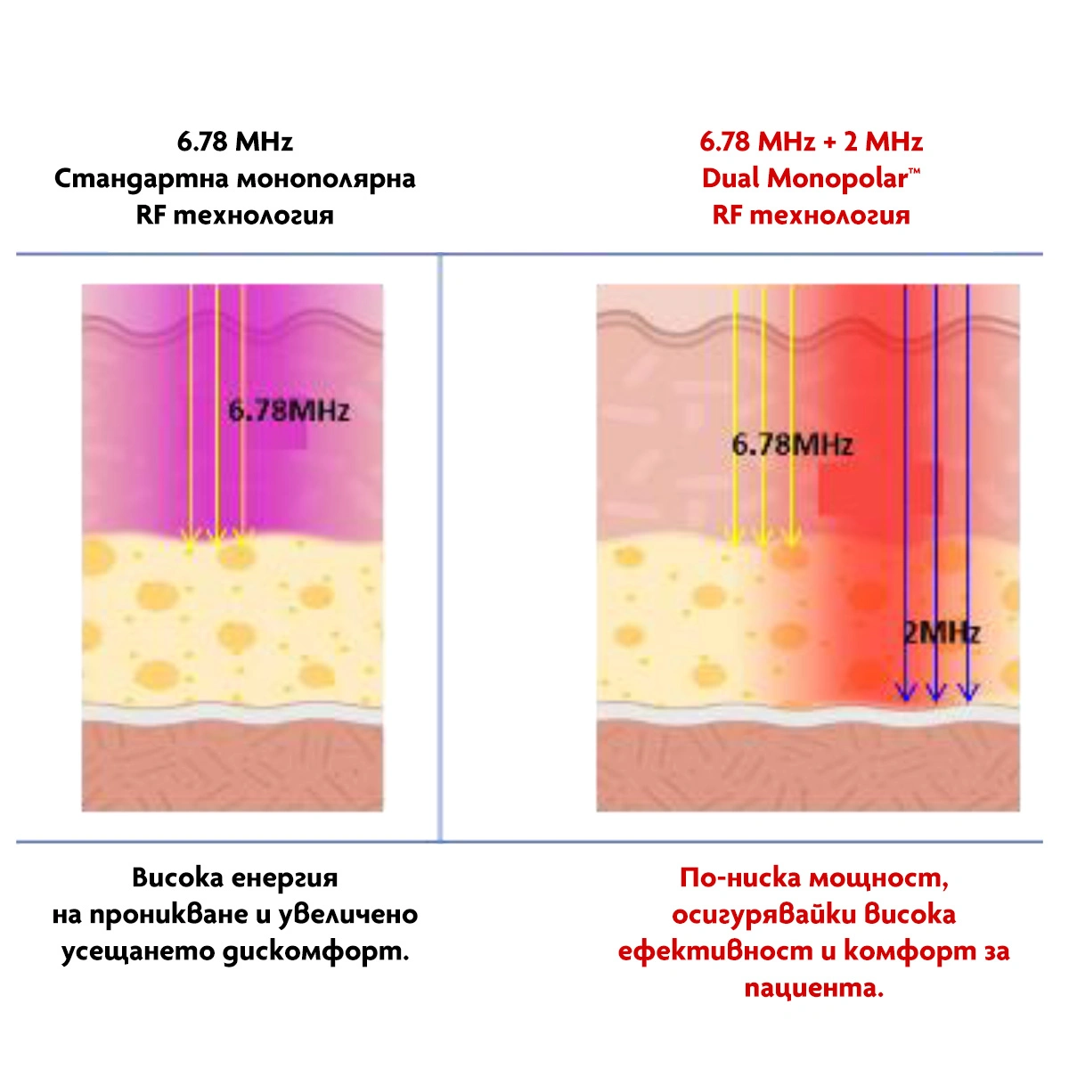 две монополярни радиочестоти - 6.78 MHz и 2 MHz